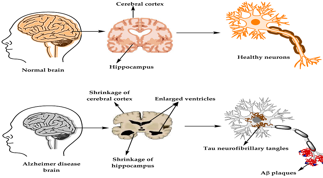 Brain - Naya Kashmir - NK