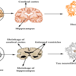 Brain - Naya Kashmir - NK