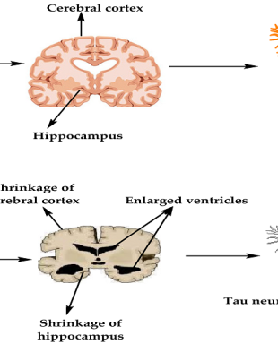Brain - Naya Kashmir - NK